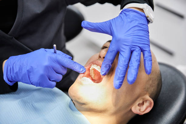 Best Emergency Dental Extractions in Rutherford, NJ